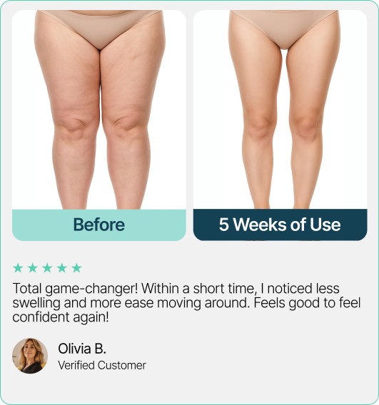 Total game-changer! Within a short time, I noticed less swelling and more ease moving around. Feels good to feel confident again!