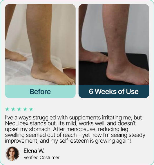 I've always struggled with supplements irritating me, but NeoLipex stands out. It’s mild, works well, and doesn’t upset my stomach. After menopause, reducing leg swelling seemed out of reach—yet now I’m seeing steady improvement, and my self-esteem is growing again!