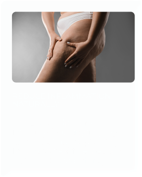 REDUCE INFLAMMATION NeoLipex helps ease inflammation, targeting leg discomfort and supporting lymphatic health, especially during hormonal changes. NATURALLY